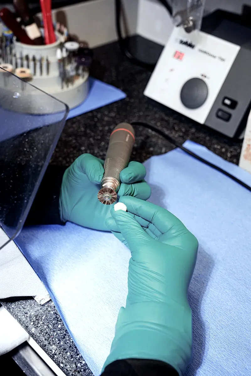 Trattamenti mininvasivi che rispettano il dente naturale.